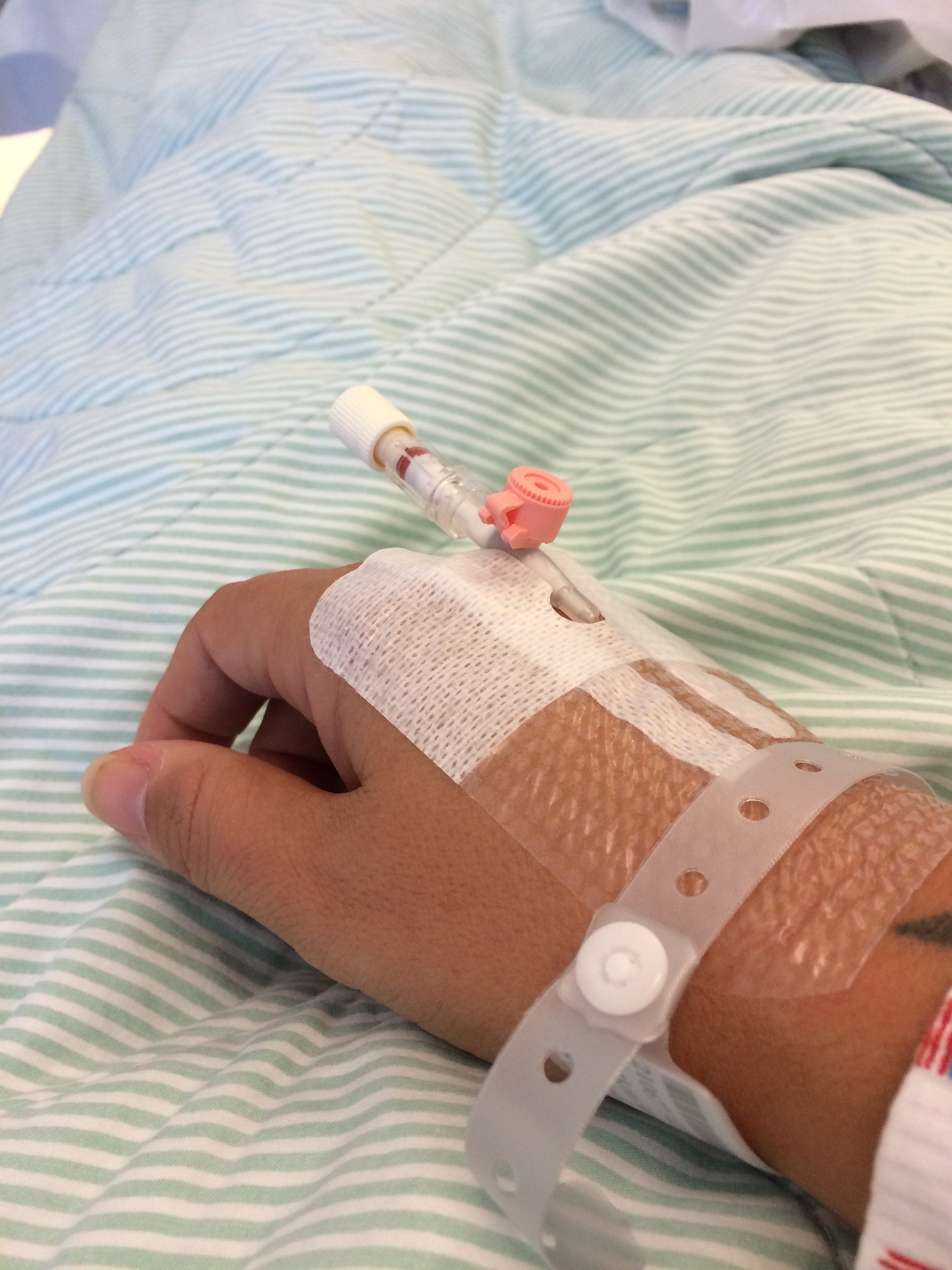 급성 심근경색(AMI) 환자의 경피적 관상동맥 중재술(PCI) 후 재관류 부정맥(Reperfusion Arrhythmia) 형태와 대동맥 내 풍선펌프(IABP) 간호 관리 반드시 알아야 할 실전 핵심