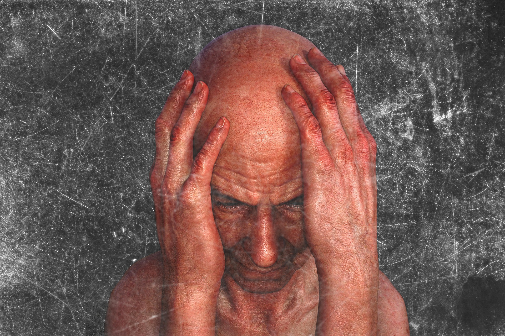 중환자실(ICU) 환자의 과다활동성 섬망(Hyperactive Delirium) 발생 시 알코올 금단성 진전섬망(DT) 감별 진단과 할로페리돌(Haloperidol) 정맥 처방 안전 가이드라인